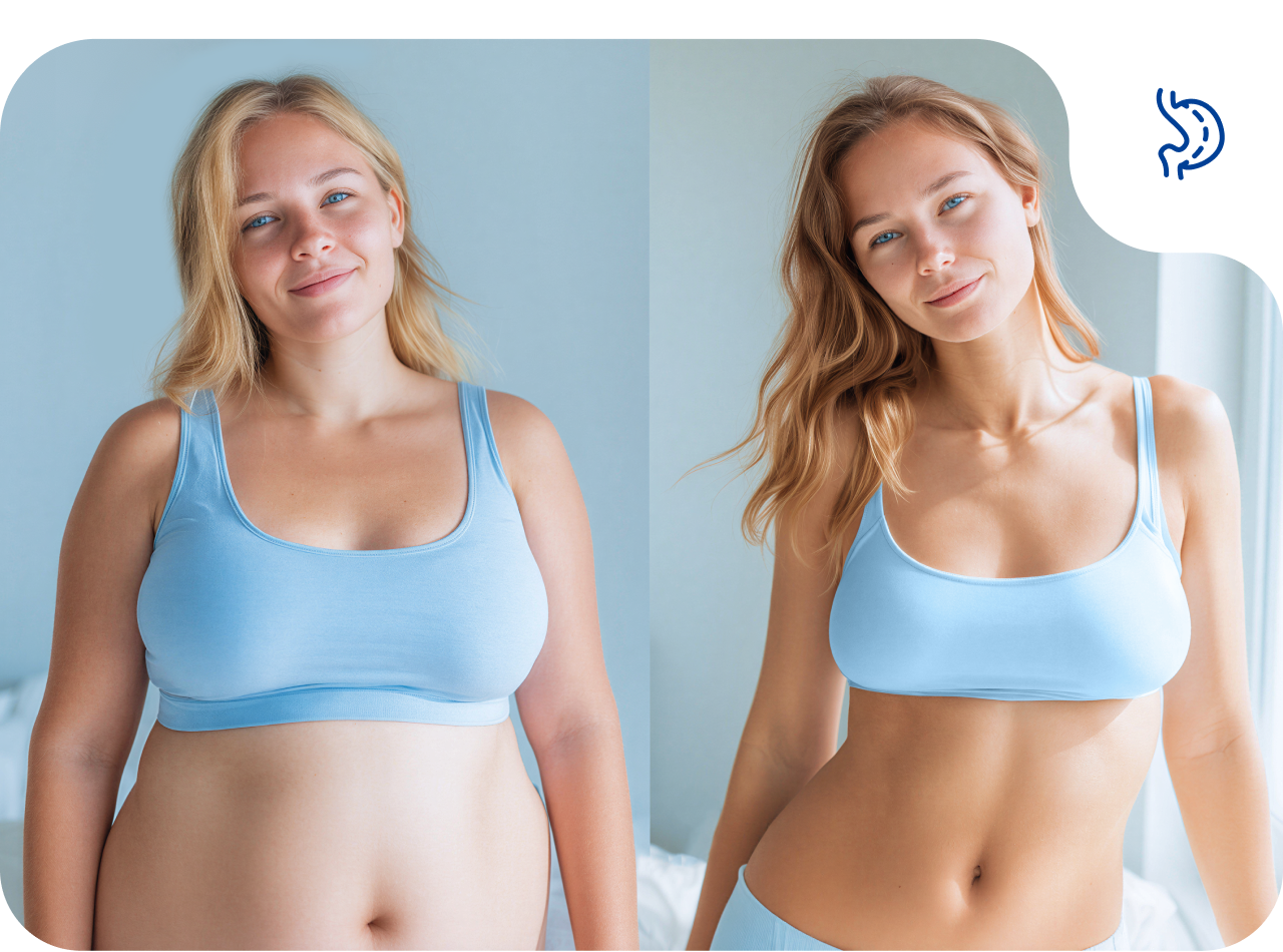 Установка желудочных баллонов