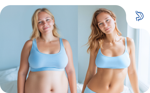 Установка желудочных баллонов